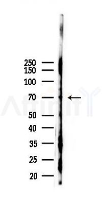 PRAM1 Antibody - Western blot analysis of lysates from K562 cells(heat-shock 45min treatment), using PRAM1 Antibody at 1/1000 dilution.