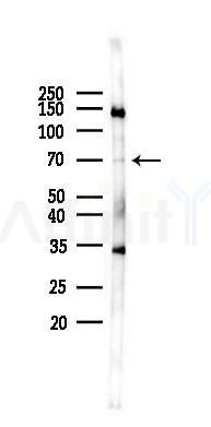 SLC34A1 Antibody - Western blot analysis of lysates from Mouse brain, using SLC34A1 Antibody at 1/1000 dilution.