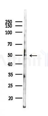 TRAIP Antibody - Western blot analysis of lysates from Mouse lung, using TRAIP Antibody at 1/1000 dilution.