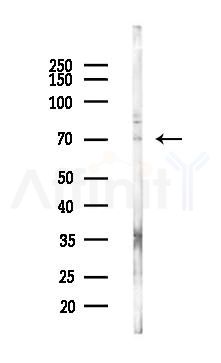 FBXL4 Antibody - Western blot analysis of lysates from Rat liver, using FBXL4 Antibody at 1/1000 dilution.