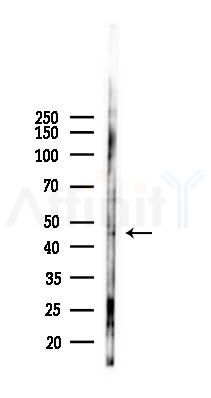 GALK2 Antibody - Western blot analysis of lysates from K562 cells(heat-shock 45min treatment), using GALK2 Antibody at 1/1000 dilution.