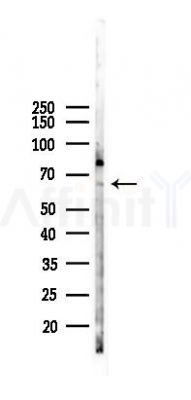 SPAG8 Antibody - Western blot analysis of lysates from K562 cells(heat-shock 45min treatment), using SPAG8 Antibody at 1/1000 dilution.