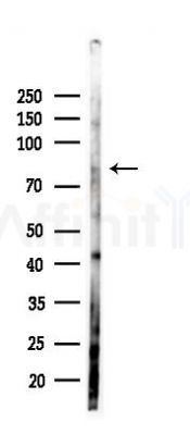 TRAF3IP1 Antibody - Western blot analysis of lysates from PC12 cells(LPS 4h treatment), using TRAF3IP1 Antibody at 1/1000 dilution.
