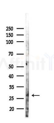 SPATA46 Antibody - Western blot analysis of lysates from PC12 cells(LPS 4h treatment), using SPATA46 Antibody at 1/1000 dilution.