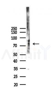 FLRT2 Antibody - Western blot analysis of lysates from K562 cells(heat-shock 45min treatment), using FLRT2 Antibody at 1/1000 dilution.
