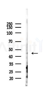 LAL Antibody - Western blot analysis of lysates from EC304 cells(starvation 24h treatment), using LAL Antibody at 1/1000 dilution.