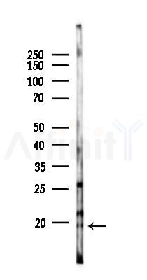 DUSP23 Antibody - Western blot analysis of lysates from Rat liver, using DUSP23 Antibody at 1/1000 dilution.