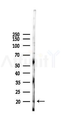 DUSP23 Antibody - Western blot analysis of lysates from K562 cells(heat-shock 45min treatment), using DUSP23 Antibody at 1/1000 dilution.