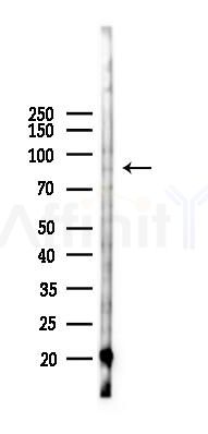 GRAMD1B Antibody - Western blot analysis of lysates from K562 cells(heat-shock 45min treatment), using GRAMD1B Antibody at 1/1000 dilution.
