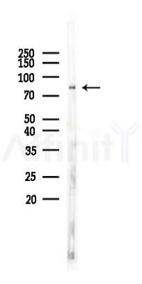 HPS6 Antibody - Western blot analysis of lysates from Mouse brain, using HPS6 Antibody at 1/1000 dilution.