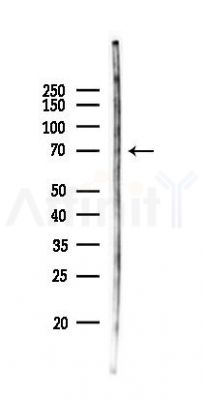 EIF4G3 Antibody - Western blot analysis of lysates from Rat liver, using EIF4G3 Antibody at 1/1000 dilution.
