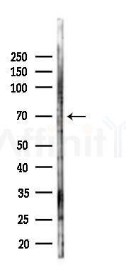 TRIM47 Antibody - Western blot analysis of lysates from PC12 cells(LPS 4h treatment), using TRIM47 Antibody at 1/1000 dilution.