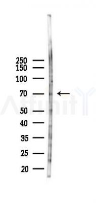 TRIM47 Antibody - Western blot analysis of lysates from K562 cells(heat-shock 45min treatment), using TRIM47 Antibody at 1/1000 dilution.