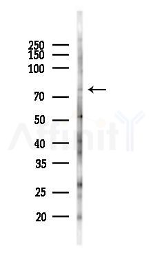CHM Antibody - Western blot analysis of lysates from PC12 cells(LPS 4h treatment), using CHM Antibody at 1/1000 dilution.