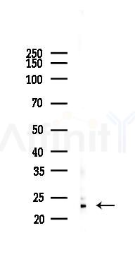 RPL23A Antibody - Western blot analysis of lysates from B16F10-LUC cells(LPS 4h treatment), using RPL23A Antibody at 1/1000 dilution.