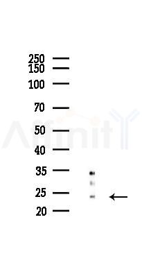 RPL23A Antibody - Western blot analysis of lysates from EC304 cells(starvation 24h treatment), using RPL23A Antibody at 1/1000 dilution.
