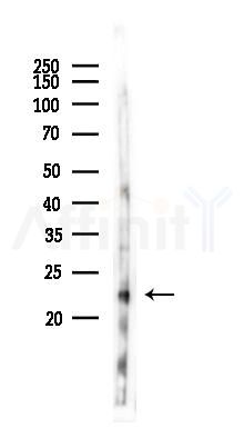 ARL4D Antibody - Western blot analysis of lysates from Rat liver, using ARL4D Antibody at 1/1000 dilution.