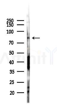 TRIM36 Antibody - Western blot analysis of lysates from B16F10-LUC cells(heat-shock 45min treatment), using TRIM36 Antibody at 1/1000 dilution.