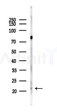 PEMT Antibody - Western blot analysis of lysates from B16F10-LUC cells(heat-shock 45min treatment), using PEMT Antibody at 1/1000 dilution.