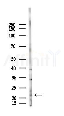 COMMD3 Antibody - Western blot analysis of lysates from Mouse lung, using COMMD3 Antibody at 1/1000 dilution.