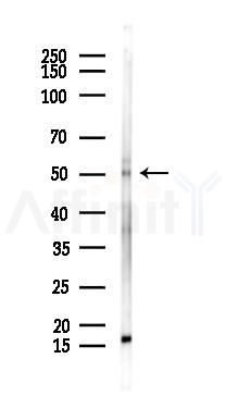 LHX2 Antibody - Western blot analysis of lysates from Rat brain, using LHX2 Antibody at 1/1000 dilution.