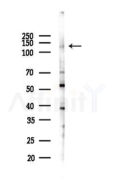 ATP13A1 Antibody - Western blot analysis of lysates from PC12 cells(LPS 4h treatment), using ATP13A1 Antibody at 1/1000 dilution.