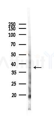 TOB2 Antibody - Western blot analysis of lysates from RAW264.