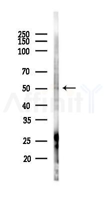 ZNF672 Antibody - Western blot analysis of lysates from PC12 cells(LPS 4h treatment), using ZNF672 Antibody at 1/1000 dilution.