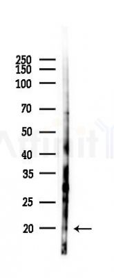 GREM1 Antibody - Western blot analysis of lysates from HUVEC cells(starvation 24h treatment), using GREM1 Antibody at 1/1000 dilution.