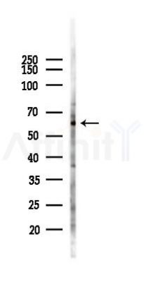 RMDN3 Antibody - Western blot analysis of lysates from B16F10-LUC cells(heat-shock 45min treatment), using RMDN3 Antibody at 1/1000 dilution.