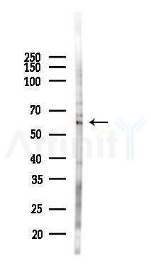 RMDN3 Antibody - Western blot analysis of lysates from PC12 cells(LPS 4h treatment), using RMDN3 Antibody at 1/1000 dilution.