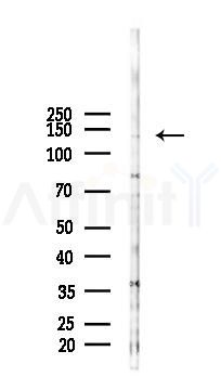SGSM1 Antibody - Western blot analysis of lysates from B16F10-LUC cells(heat-shock 45min treatment), using SGSM1 Antibody at 1/1000 dilution.
