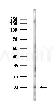 FXYD5 Antibody - Western blot analysis of lysates from PC12 cells(LPS 4h treatment), using FXYD5 Antibody at 1/1000 dilution.