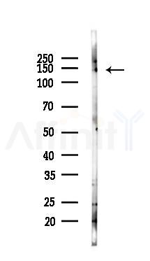 ERCC6L Antibody - Western blot analysis of lysates from K562 cells(starvation 24h treatment), using ERCC6L Antibody at 1/1000 dilution.