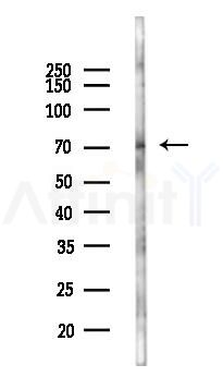 FAM111A Antibody - Western blot analysis of lysates from PC12 cells(LPS 4h treatment), using FAM111A Antibody at 1/1000 dilution.