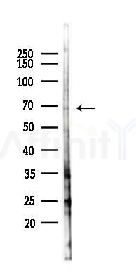 KLHL12 Antibody - Western blot analysis of lysates from HUVEC cells(LPS 4h treatment), using KLHL12 Antibody at 1/1000 dilution.