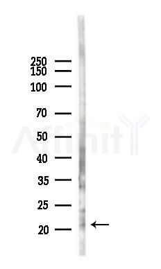 RABAC1 Antibody - Western blot analysis of lysates from B16F10-LUC cells(heat-shock 45min treatment), using RABAC1 Antibody at 1/1000 dilution.