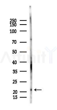 RABAC1 Antibody - Western blot analysis of lysates from Rat brain, using RABAC1 Antibody at 1/1000 dilution.