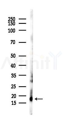 FUNDC1 antibody - Western blot analysis of lysates from Mouse lung, using FUNDC1 antibody at 1/1000 dilution.