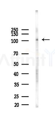 MTMR14 Antibody - Western blot analysis of lysates from Mouse testis, using MTMR14 Antibody at 1/1000 dilution.