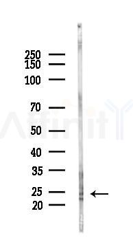 NMNAT3 Antibody - Western blot analysis of lysates from Rat testis, using NMNAT3 Antibody at 1/1000 dilution.