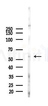 FSCN2 Antibody - Western blot analysis of lysates from B16F10-LUC cells(heat-shock 45min treatment), using FSCN2 Antibody at 1/1000 dilution.