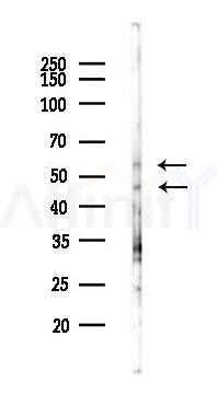SIGIRR Antibody - Western blot analysis of lysates from PC12 cells(LPS 4h treatment), using SIGIRR Antibody at 1/1000 dilution.