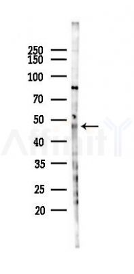 ZBTB32 Antibody - Western blot analysis of lysates from HUVEC cells(LPS 4h treatment), using ZBTB32 Antibody at 1/1000 dilution.