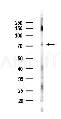 MON1A Antibody - Western blot analysis of lysates from Rat liver, using MON1A Antibody at 1/1000 dilution.