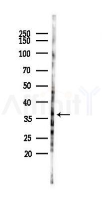 CLYBL Antibody - Western blot analysis of lysates from HUVEC cells(LPS 4h treatment), using CLYBL Antibody at 1/1000 dilution.