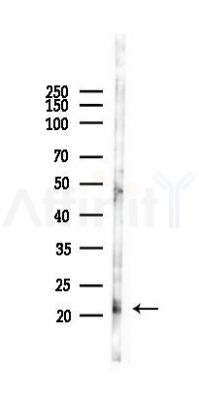 ABHD14B Antibody - Western blot analysis of lysates from PC12 cells(LPS 4h treatment), using ABHD14B Antibody at 1/1000 dilution.