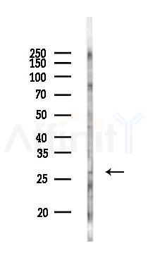 TEX35 Antibody - Western blot analysis of lysates from Rat lung, using TEX35 Antibody at 1/1000 dilution.