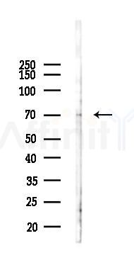 FEM1B Antibody - Western blot analysis of lysates from B16F10-LUC cells(heat-shock 45min treatment), using FEM1B Antibody at 1/1000 dilution.