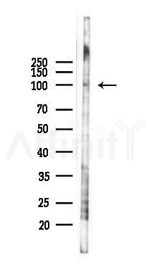 EPC1 Antibody - Western blot analysis of lysates from PC12 cells(LPS 4h treatment), using EPC1 Antibody at 1/1000 dilution.